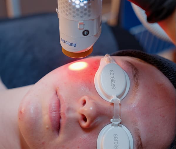 Person receiving red light facial treatment using an Aerolase laser device with protective eyewear.